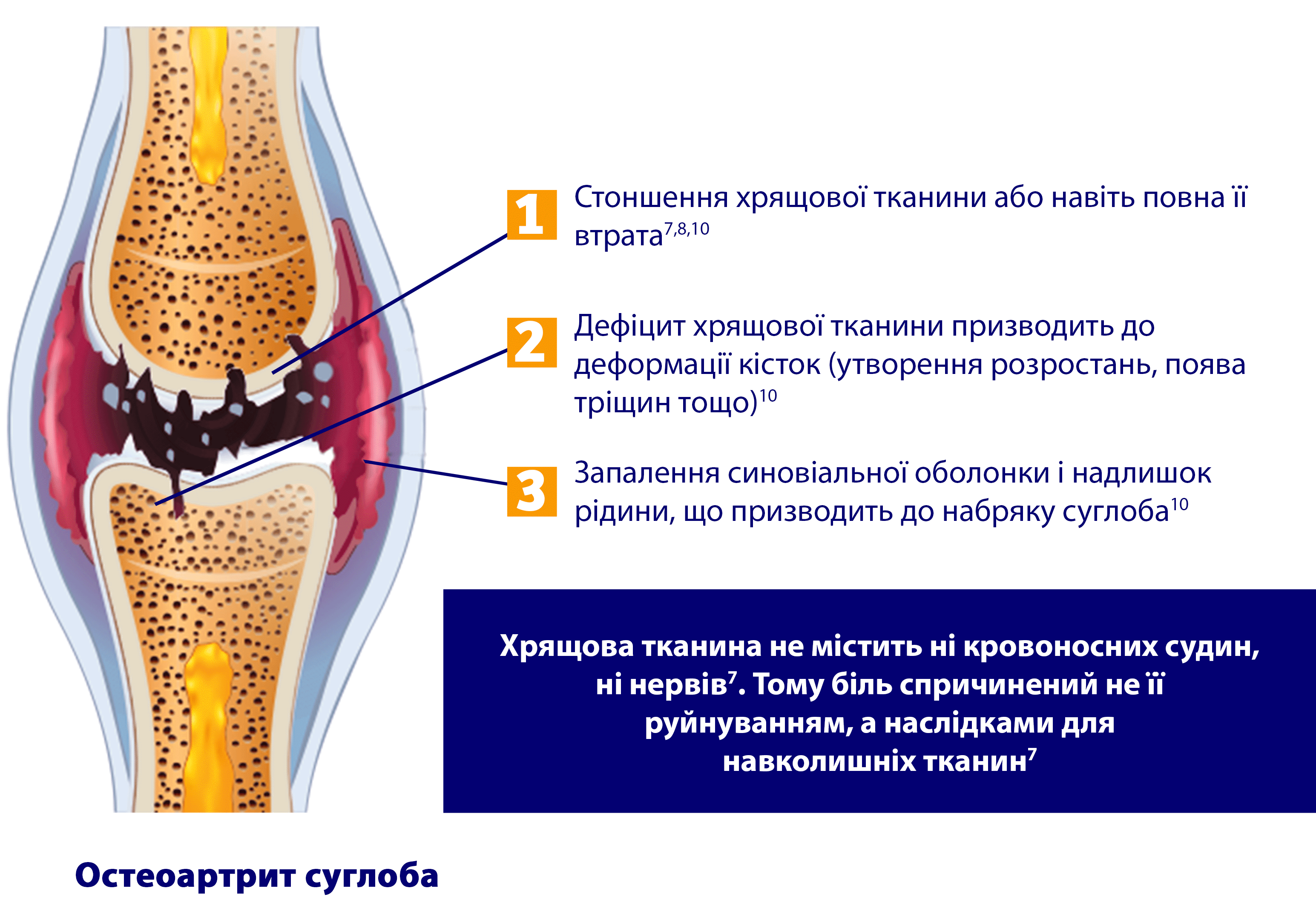 articulation avec de l'arthrose